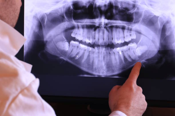 Best Emergency Tooth Extraction in Riverview, MI