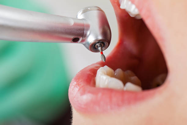 Best Urgent Dental Care in Riverview, MI